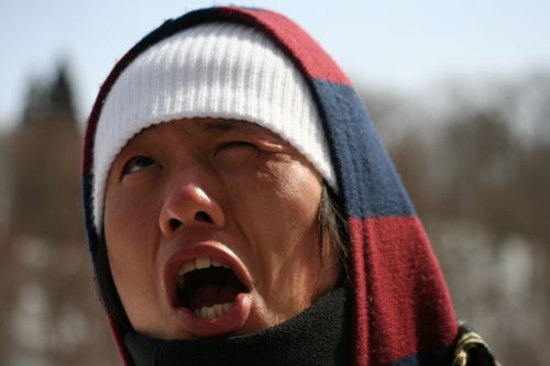タカヒロ　骨折中